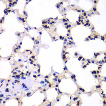 HR6B / UBE2B Antibody - Immunohistochemistry of paraffin-embedded rat lung tissue.