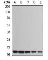 HR6B / UBE2B Antibody - Western blot analysis of UBE2B expression in Jurkat (A); NIH3T3 (B); mouse heart (C); rat heart (D); rat brain (E) whole cell lysates.