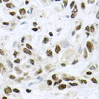 HR6B / UBE2B Antibody - Immunohistochemical analysis of UBE2B staining in rat lung formalin fixed paraffin embedded tissue section. The section was pre-treated using heat mediated antigen retrieval with sodium citrate buffer (pH 6.0). The section was then incubated with the antibody at room temperature and detected using an HRP conjugated compact polymer system. DAB was used as the chromogen. The section was then counterstained with hematoxylin and mounted with DPX.