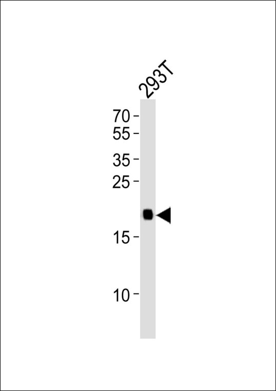 HRAS / H-Ras Antibody - Western blot of lysate from 293T cell line, using HRAS Antibody. Antibody was diluted at 1:1000. A goat anti-rabbit IgG H&L (HRP) at 1:10000 dilution was used as the secondary antibody. Lysate at 20ug.