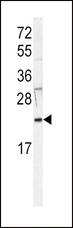 HRAS / H-Ras Antibody - Western blot of anti-HRAS Antibody in Jurkat cell line lysates (35 ug/lane). HRAS (arrow) was detected using the purified antibody.