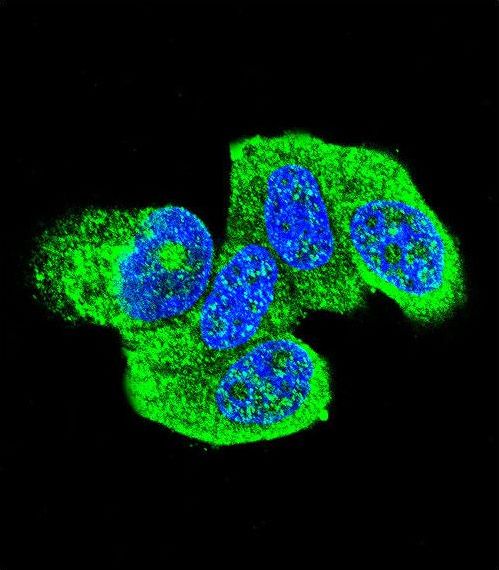 HRAS / H-Ras Antibody - Confocal immunofluorescence of HRAS Antibody with MCF-7 cell followed by Alexa Fluor 488-conjugated goat anti-rabbit lgG (green). DAPI was used to stain the cell nuclear (blue).