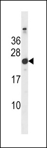 HRAS / H-Ras Antibody - Mouse Hras1 Antibody western blot of mouse bladder tissue lysates (35 ug/lane). The Mouse Hras1 antibody detected the Mouse Hras1 protein (arrow).