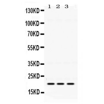HRAS / H-Ras Antibody - GTPase HRAS antibody Western blot. All lanes: Anti GTPase HRAS at 0.5 ug/ml. Lane 1: Mouse Brain Tissue Lysate at 50 ug. Lane 2: HELA Whole Cell Lysate at 40 ug. Lane 3: A549 Whole Cell Lysate at 40 ug. Predicted band size: 21 kD. Observed band size: 21 kD.