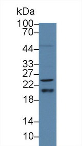 HRAS / H-Ras Antibody - Western Blot; Sample: Human HepG2 cell lysate; Primary Ab: 5µg/ml Rabbit Anti-Human HRAS Antibody Second Ab: 0.2µg/mL HRP-Linked Caprine Anti-Rabbit IgG Polyclonal Antibody