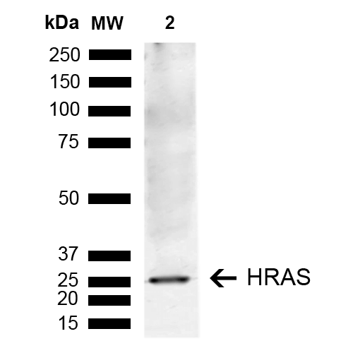 HRAS / H-Ras Antibody - Western blot analysis of Human Lung carcinoma epithelial cell line (A549) lysate showing detection of ~21.3 kDa HRAS protein using Rabbit Anti-HRAS Polyclonal Antibody. Lane 1: Molecular Weight Ladder (MW). Lane 2: A549. Load: 10 µg. Block: 5% Skim Milk in 1X TBST. Primary Antibody: Rabbit Anti-HRAS Polyclonal Antibody  at 1:1000 for 2 hours at RT. Secondary Antibody: Goat Anti-Rabbit IgG: HRP at 1:5000 for 1 hour at RT. Color Development: ECL solution for 5 min at RT. Predicted/Observed Size: ~21.3 kDa. Other Band(s): 25 kDa.