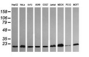 HRAS / H-Ras Antibody - Western blot of extracts (35 ug) from 9 different cell lines by using anti-HRAS monoclonal antibody (HepG2: human; HeLa: human; SVT2: mouse; A549: human; COS7: monkey; Jurkat: human; MDCK: canine; PC12: rat; MCF7: human).