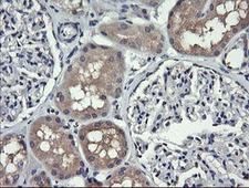 HRAS / H-Ras Antibody - IHC of paraffin-embedded Human Kidney tissue using anti-HRAS mouse monoclonal antibody.