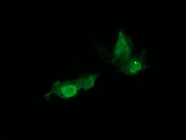 HRAS / H-Ras Antibody - Anti-HRAS mouse monoclonal antibody immunofluorescent staining of COS7 cells transiently transfected by pCMV6-ENTRY HRAS.