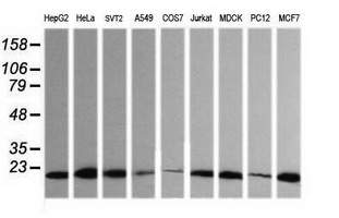 HRAS / H-Ras Antibody - Western blot of extracts (35 ug) from 9 different cell lines by using g anti-HRAS monoclonal antibody (HepG2: human; HeLa: human; SVT2: mouse; A549: human; COS7: monkey; Jurkat: human; MDCK: canine; PC12: rat; MCF7: human).