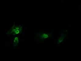 HRAS / H-Ras Antibody - Immunofluorescent staining of HeLa cells using anti-HRAS mouse monoclonal antibody.
