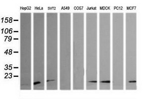 HRAS / H-Ras Antibody - Western blot of extracts (35 ug) from 9 different cell lines by using g anti-HRAS monoclonal antibody (HepG2: human; HeLa: human; SVT2: mouse; A549: human; COS7: monkey; Jurkat: human; MDCK: canine; PC12: rat; MCF7: human).