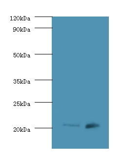 HRAS / H-Ras Antibody - Western blot of GTPase Hras antibody at 2 ug/ml Lane1:293T whole cell lysate Lane2:: mouse brain tissue Secondary Goat polyclonal to Rabbit IgG at 1:10000 dilution. Predicted band size: 21 KDa. Observed band size: 21 KDa.  This image was taken for the unconjugated form of this product. Other forms have not been tested.