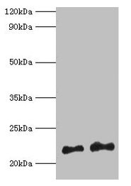 HRAS / H-Ras Antibody - Western blot All lanes: GTPase Hras antibody at 2µg/ml Lane 1: 293T whole cell lysate Lane 2: Mouse brain tissue Secondary Goat polyclonal to rabbit IgG at 1/10000 dilution Predicted band size: 21 kDa Observed band size: 21 kDa