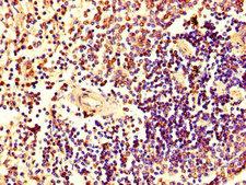 HRAS / H-Ras Antibody - Immunohistochemistry of paraffin-embedded human spleen tissue using HRAS Antibody at dilution of 1:100