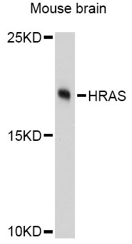 HRAS / H-Ras Antibody - Western blot analysis of extracts of mouse brain, using HRAS Antibody at 1:3000 dilution. The secondary antibody used was an HRP Goat Anti-Rabbit IgG (H+L) at 1:10000 dilution. Lysates were loaded 25ug per lane and 3% nonfat dry milk in TBST was used for blocking. An ECL Kit was used for detection and the exposure time was 90s.