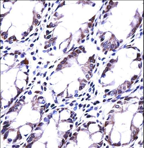 HRASLS5 Antibody - HRASLS5 Antibody immunohistochemistry of formalin-fixed and paraffin-embedded human rectum tissue followed by peroxidase-conjugated secondary antibody and DAB staining.