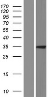HRASLS5 Protein - Western validation with an anti-DDK antibody * L: Control HEK293 lysate R: Over-expression lysate