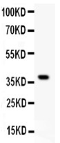 HRG Antibody - HRG antibody Western blot. All lanes: Anti HRG at 0.5 ug/ml. WB: Recombinant Human HRG Protein 0.5ng. Predicted band size: 40 kD. Observed band size: 40 kD.