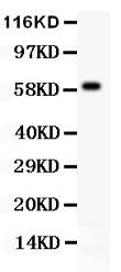 HRG Antibody - HRG antibody Western blot. All lanes: Anti HRG at 0.5 ug/ml. WB: Human Placenta Tissue Lysate at 50 ug. Predicted band size: 60 kD. Observed band size: 60 kD.