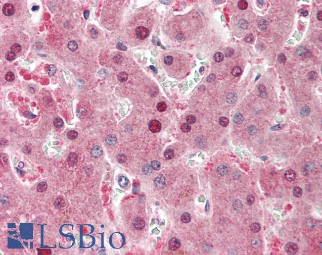HRG Antibody - Anti-HRG antibody IHC staining of human liver. Immunohistochemistry of formalin-fixed, paraffin-embedded tissue after heat-induced antigen retrieval.  This image was taken for the unconjugated form of this product. Other forms have not been tested.