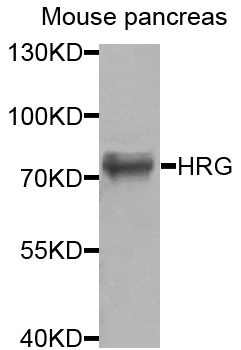 HRG Antibody - Western blot analysis of extracts of mouse pancreas cells.