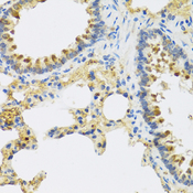 HRG Antibody - Immunohistochemistry of paraffin-embedded rat lung tissue.