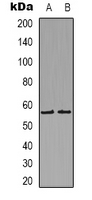 HRH1 / Histamine H1 Receptor Antibody - Western blot analysis of Histamine H1 Receptor expression in HeLa (A); COLO205 (B) whole cell lysates.