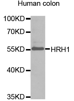 HRH1 / Histamine H1 Receptor Antibody - Western blot analysis of extracts of human colon, using HRH1 antibody. The secondary antibody used was an HRP Goat Anti-Rabbit IgG (H+L) at 1:10000 dilution. Lysates were loaded 25ug per lane and 3% nonfat dry milk in TBST was used for blocking.