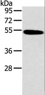 HRH1 / Histamine H1 Receptor Antibody - Western blot analysis of Human normal colon tissue, using HRH1 Polyclonal Antibody at dilution of 1:200.