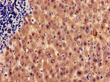 HRH1 / Histamine H1 Receptor Antibody - Immunohistochemistry of paraffin-embedded human liver tissue at dilution of 1:100