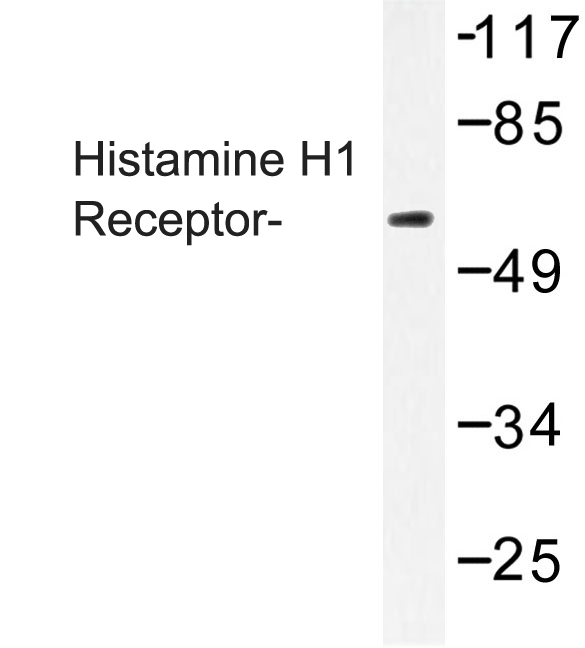 HRH1 / Histamine H1 Receptor Antibody - Western blot of Histamine H1 Receptor (K179) pAb in extracts from COLO205 cells.