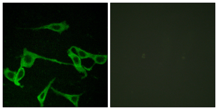 HRH2 / Histamine H2 Receptor Antibody - Immunofluorescence analysis of LOVO cells, using HRH2 Antibody. The picture on the right is blocked with the synthesized peptide.