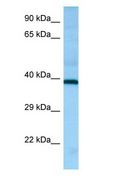 HRH2 / Histamine H2 Receptor Antibody - HRH2 / Histamine H2 Receptor antibody Western Blot of Fetal Brain.  This image was taken for the unconjugated form of this product. Other forms have not been tested.