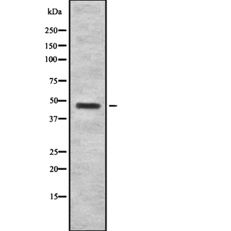 HRH2 / Histamine H2 Receptor Antibody - Western blot analysis of HRH2 using HepG2 whole cells lysates