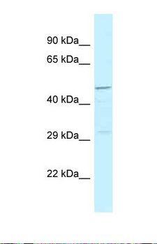 HRH3 / Histamine 3 Receptor Antibody - Western blot of Human Hela . HRH3 antibody dilution 1.0 ug/ml.  This image was taken for the unconjugated form of this product. Other forms have not been tested.