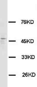 HRH3 / Histamine 3 Receptor Antibody -  This image was taken for the unconjugated form of this product. Other forms have not been tested.