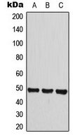 HRH3 / Histamine 3 Receptor Antibody - Western blot analysis of Histamine H3 Receptor expression in HeLa (A); A549 (B); Raw264.7 (C) whole cell lysates.