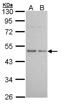 HRH3 / Histamine 3 Receptor Antibody - Sample (30 ug of whole cell lysate). A: A431. B: H1299. 10% SDS PAGE. HRH3 antibody diluted at 1:1000. 
