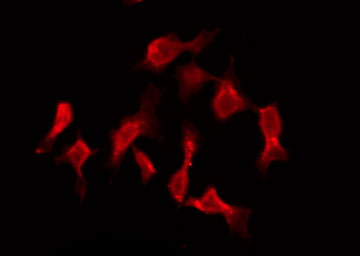 HRH3 / Histamine 3 Receptor Antibody - Staining COLO205 cells by IF/ICC. The samples were fixed with PFA and permeabilized in 0.1% Triton X-100, then blocked in 10% serum for 45 min at 25°C. The primary antibody was diluted at 1:200 and incubated with the sample for 1 hour at 37°C. An Alexa Fluor 594 conjugated goat anti-rabbit IgG (H+L) Ab, diluted at 1/600, was used as the secondary antibody.