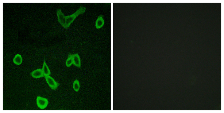 HRH4 / Histamine H4 Receptor Antibody - Immunofluorescence analysis of LOVO cells, using HRH4 Antibody. The picture on the right is blocked with the synthesized peptide.