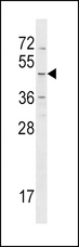 HRH4 / Histamine H4 Receptor Antibody - HRH4 Antibody western blot of NCI-H460 cell line lysates (35 ug/lane). The HRH4 antibody detected the HRH4 protein (arrow).