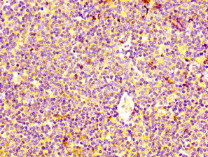 HRH4 / Histamine H4 Receptor Antibody - Immunohistochemistry image at a dilution of 1:400 and staining in paraffin-embedded human lymph node tissue performed on a Leica BondTM system. After dewaxing and hydration, antigen retrieval was mediated by high pressure in a citrate buffer (pH 6.0) . Section was blocked with 10% normal goat serum 30min at RT. Then primary antibody (1% BSA) was incubated at 4 °C overnight. The primary is detected by a biotinylated secondary antibody and visualized using an HRP conjugated SP system.