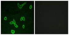 HRH4 / Histamine H4 Receptor Antibody - Peptide - + Immunofluorescence analysis of LOVO cells, using HRH4 antibody.