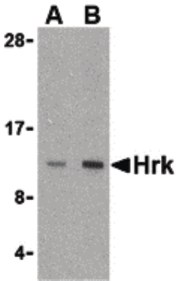 HRK / HARAKIRI Antibody - Western blot of Hrk in mouse pancreas tissue lysate with Hrk antibody at (A) 2.5 and (B) 5 ug/ml.