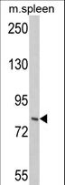 HRS / HGS Antibody - Western blot of hIMOS-1-Q271 in mouse spleen tissue lysates (35 ug/lane). IMOS-1 (arrow) was detected using the purified antibody.
