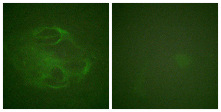 HRS / HGS Antibody - Immunofluorescence analysis of HeLa cells, using HRS Antibody. The picture on the right is blocked with the synthesized peptide.