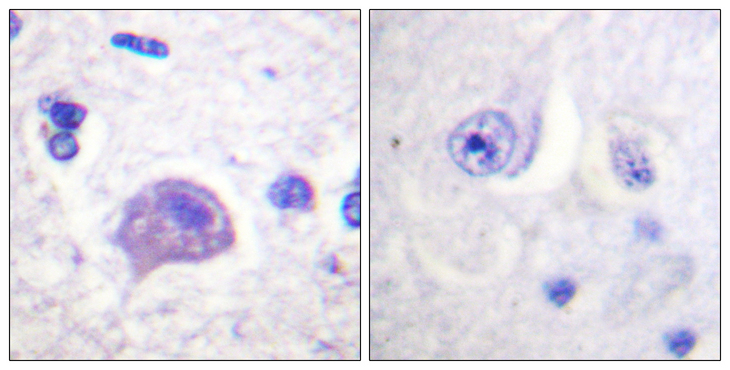 HRS / HGS Antibody - Immunohistochemistry analysis of paraffin-embedded human brain tissue, using HRS Antibody. The picture on the right is blocked with the synthesized peptide.