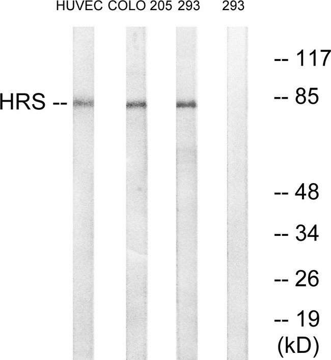 HRS / HGS Antibody - Western blot analysis of lysates from 293, COLO, and HUVEC cells, using HRS Antibody. The lane on the right is blocked with the synthesized peptide.