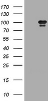 HRS / HGS Antibody - HEK293T cells were transfected with the pCMV6-ENTRY control (Left lane) or pCMV6-ENTRY HGS (Right lane) cDNA for 48 hrs and lysed. Equivalent amounts of cell lysates (5 ug per lane) were separated by SDS-PAGE and immunoblotted with anti-HGS.